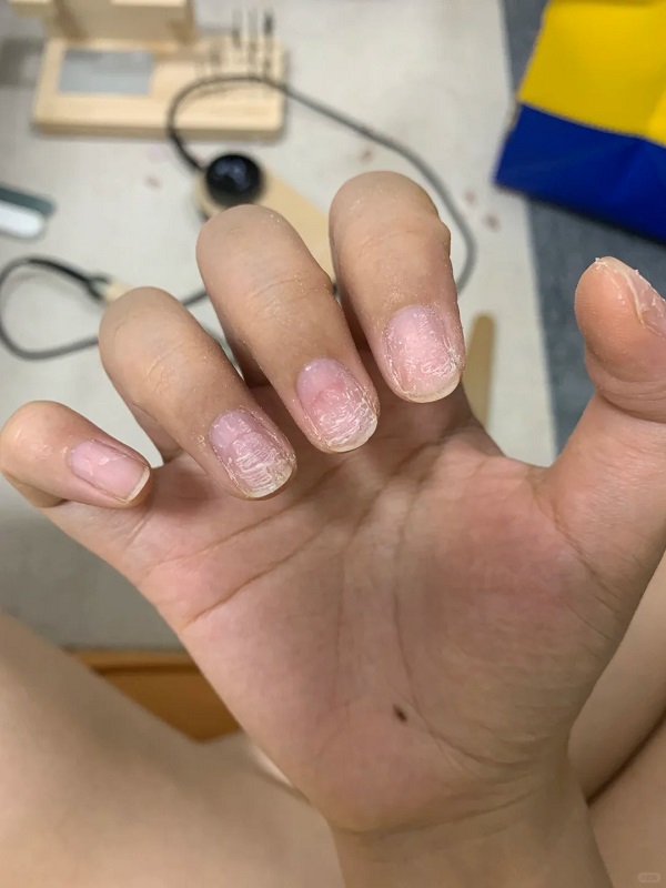 cách gỡ bỏ móng tay giả