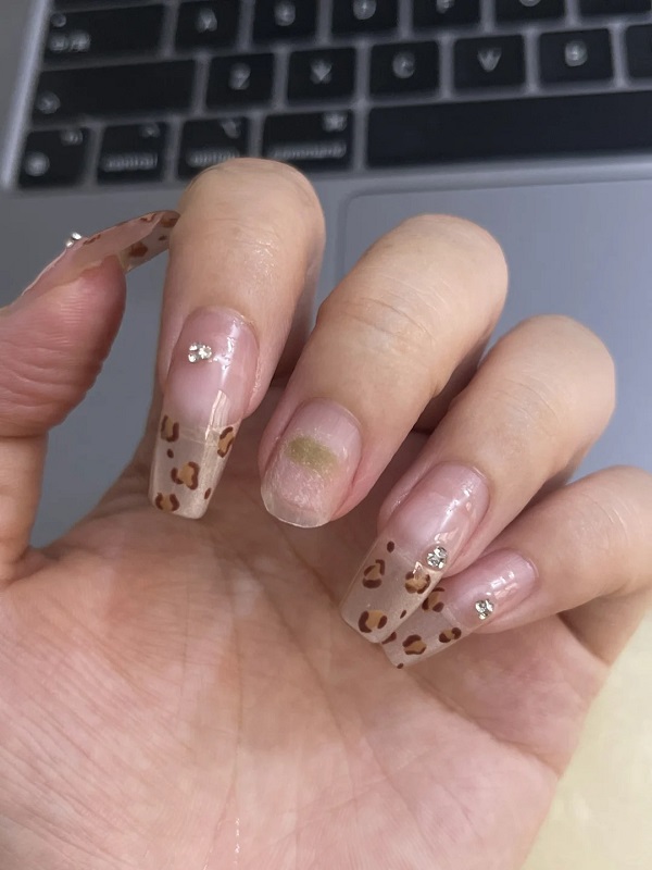 hình ảnh nấm móng tay