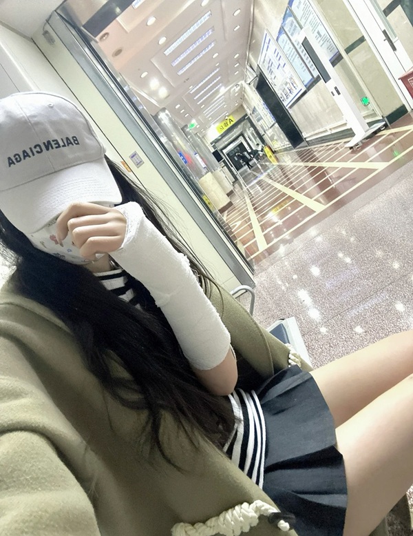 hình ảnh gãy tay 10