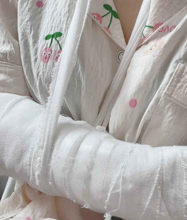 hình ảnh gãy tay 26