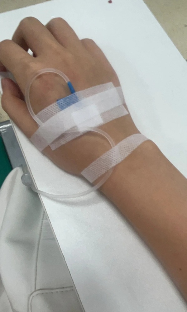 ảnh truyền nước ở tay nam 1