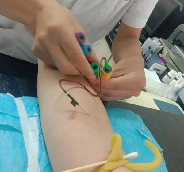 ảnh truyền nước ở tay nam 12