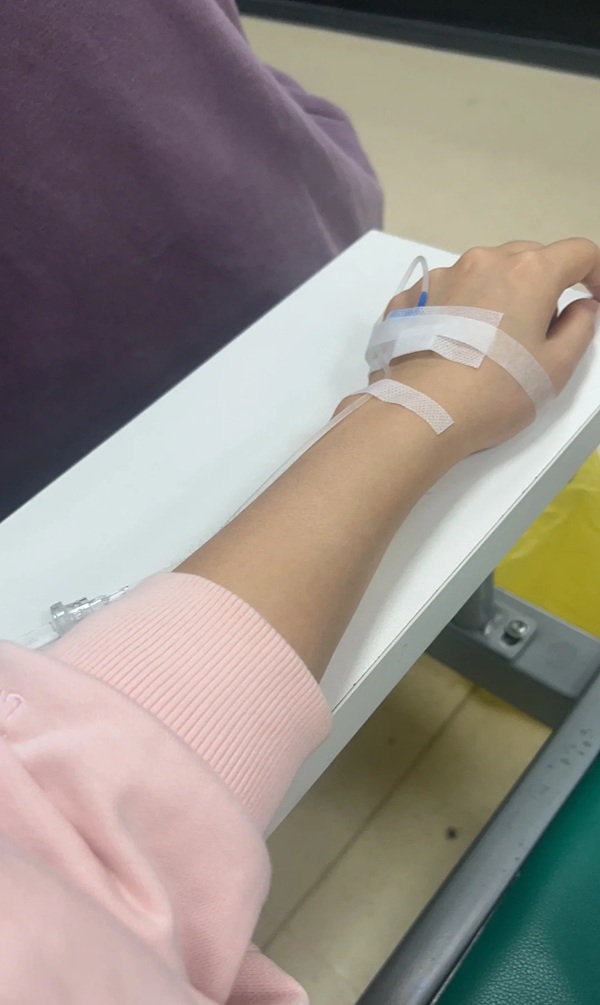 ảnh truyền nước ở tay nam 2