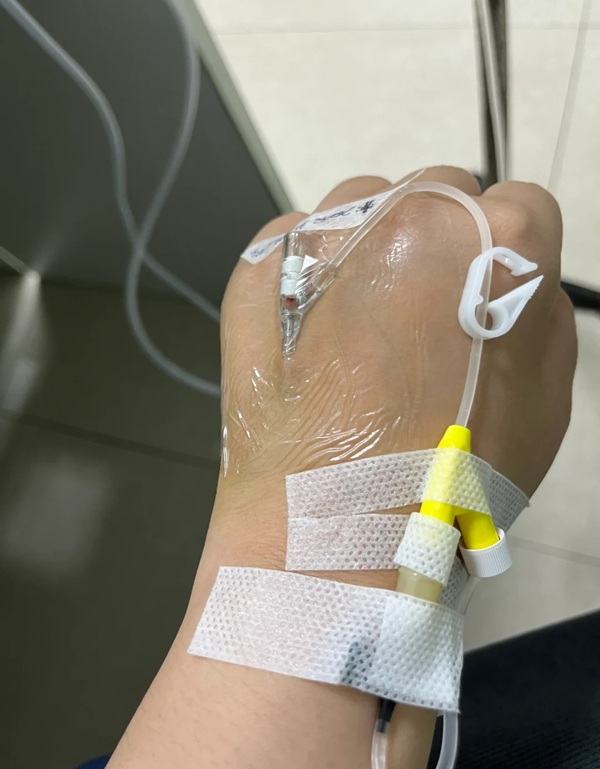 ảnh truyền nước ở tay nam 20