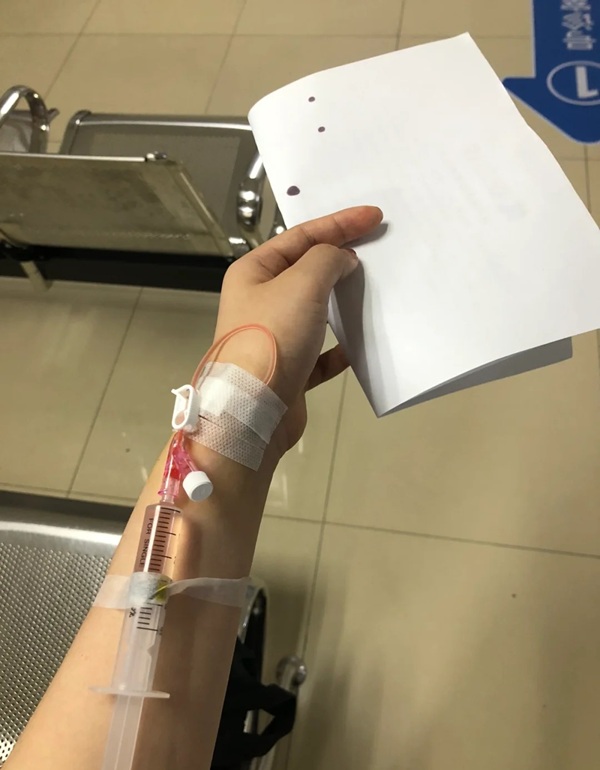 ảnh truyền nước ở tay nam 23