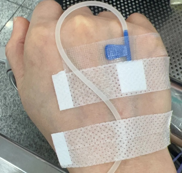 ảnh truyền nước ở tay nam 24