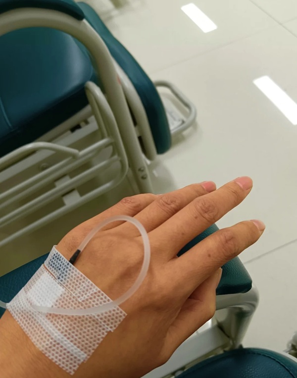 ảnh truyền nước ở tay nam 28