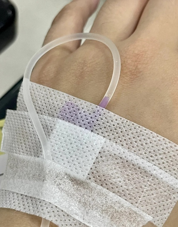 ảnh truyền nước ở tay nam 29