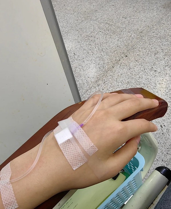 ảnh truyền nước ở tay nam 31