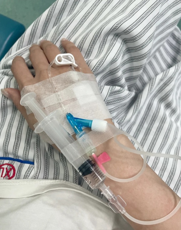 ảnh truyền nước ở tay nam 33