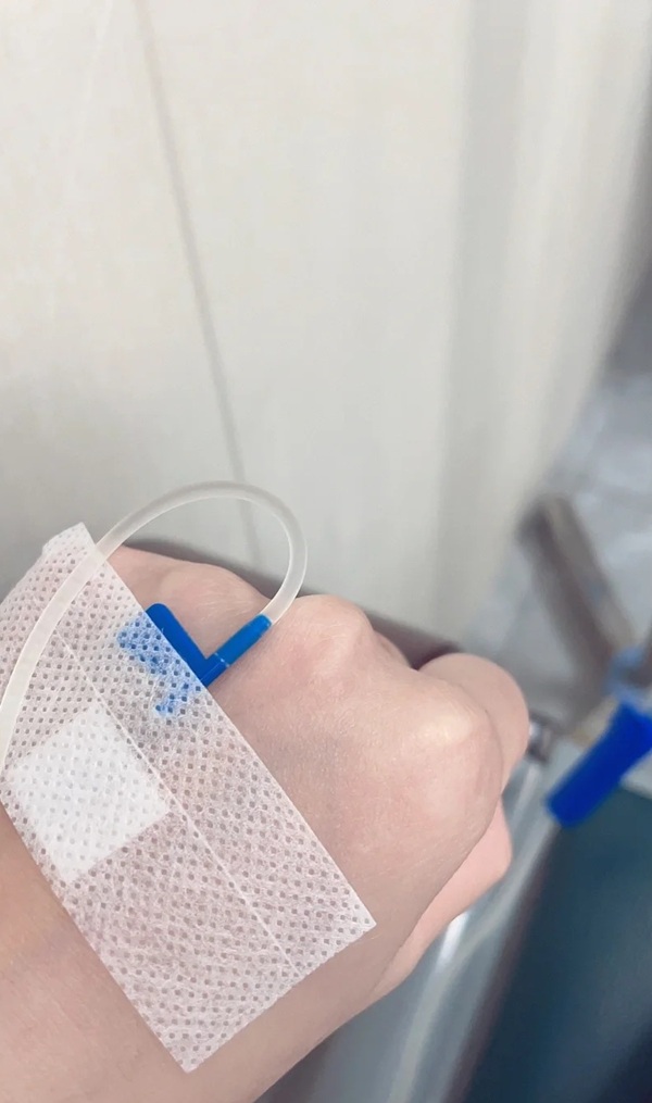 ảnh truyền nước ở tay nam 35