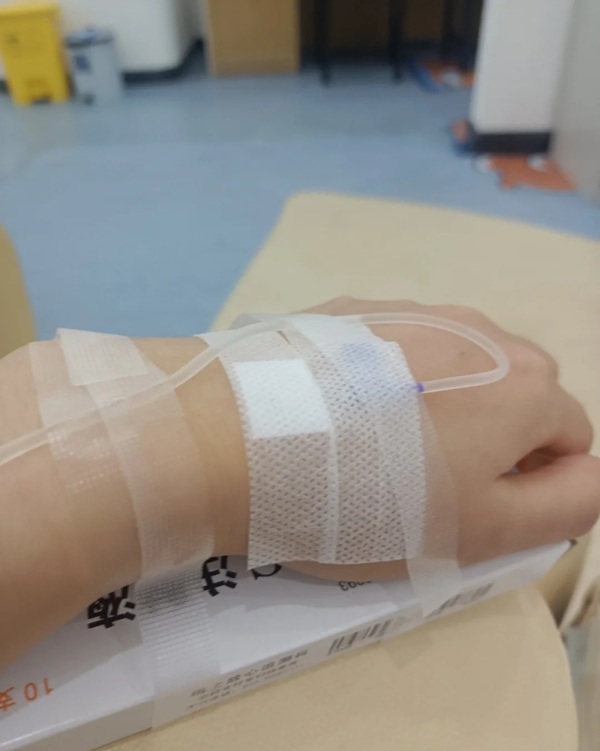 ảnh truyền nước ở tay nam 36