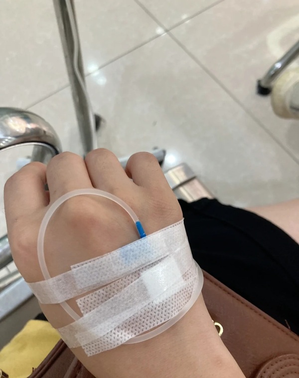ảnh truyền nước ở tay nam 38