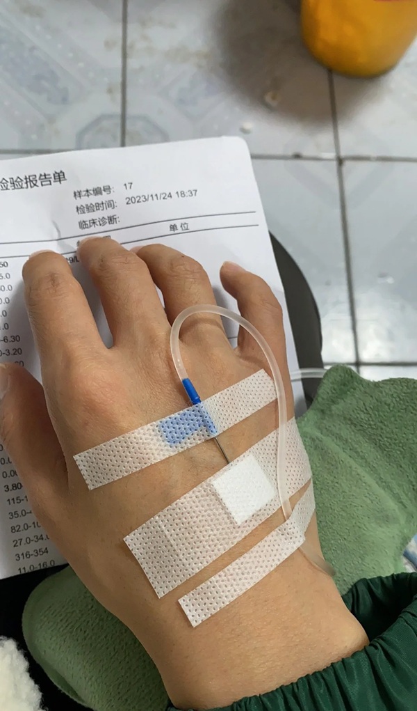 ảnh truyền nước ở tay nam 39