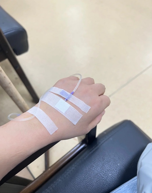 ảnh truyền nước ở tay nam 42