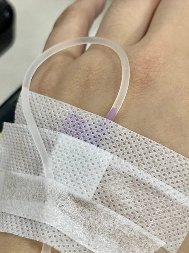 ảnh truyền nước ở tay nam 29